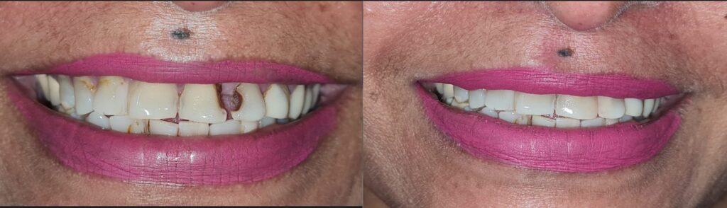 cosmetic dental care